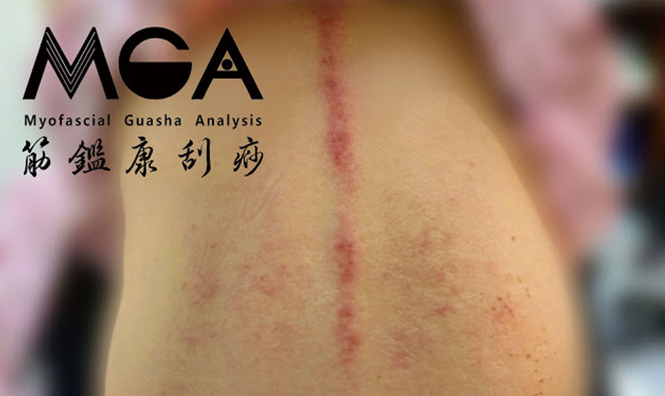[刮痧知識] 刮痧也可以刮生理期? – 經血量不足