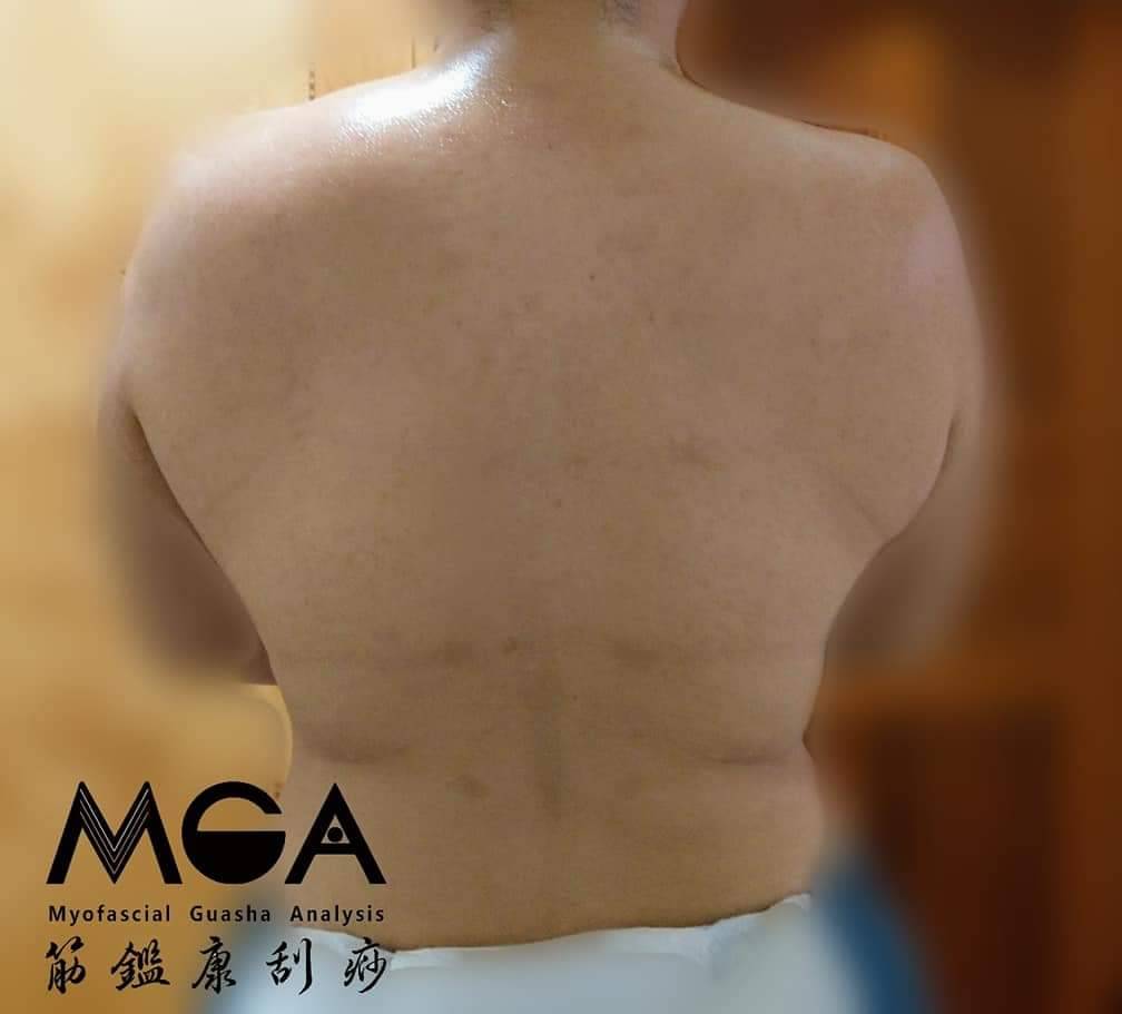 [刮痧知識] 科學刮痧，帶領你更有效率的重訓歷程！
