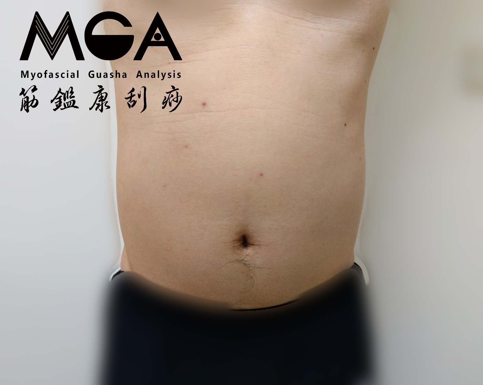 [刮痧知識] 工作忙碌、壓力大，肚子突然也變大，MGA刮痧可以快速瘦肚子或消脹氣嗎?!