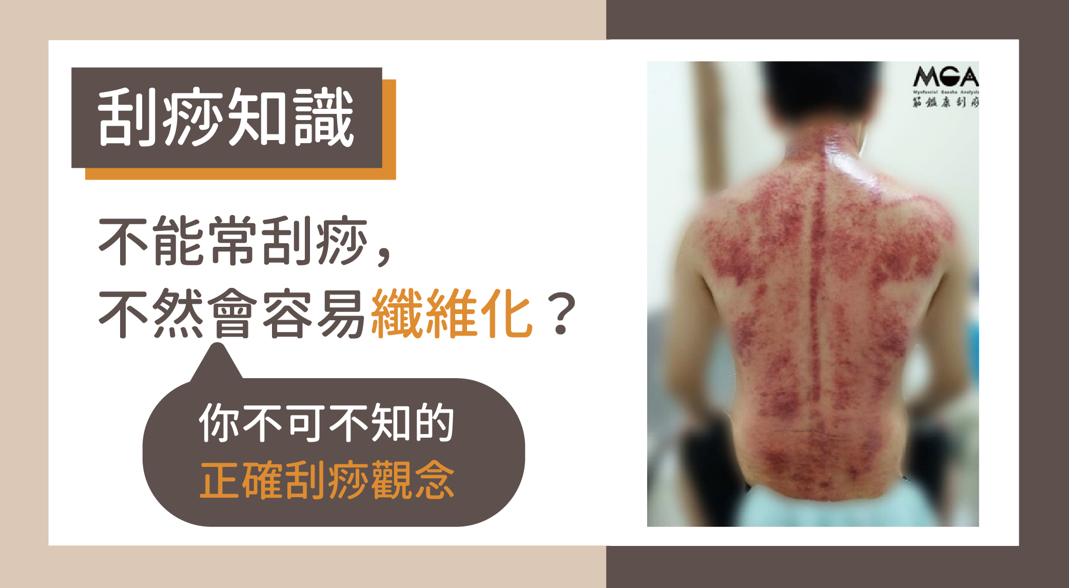 [刮痧知識] 不能常刮痧，不然會容易纖維化?! 會刮痧的你，不可不知的正確刮痧觀念！